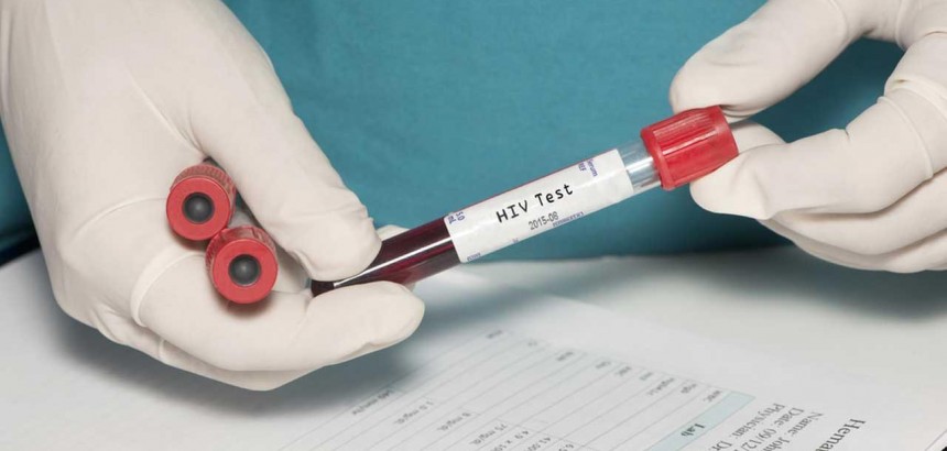 Минздрав разработал план по реализации государственной стратегии противодействия вирусу иммунодефицита человека (ВИЧ) в России