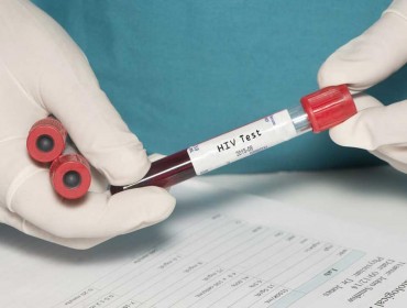 Минздрав разработал план по реализации государственной стратегии противодействия вирусу иммунодефицита человека (ВИЧ) в России