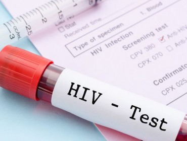 Неделя экспресс-тестирования на ВИЧ и гепатит В в Калужском СПИД-центре