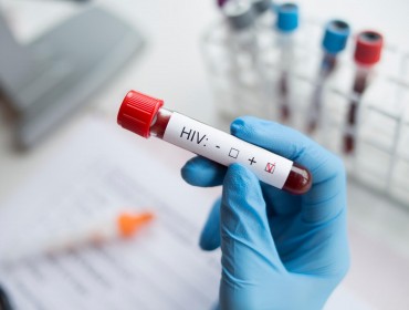 Экспресс тестирование на ВИЧ и гепатит С.
