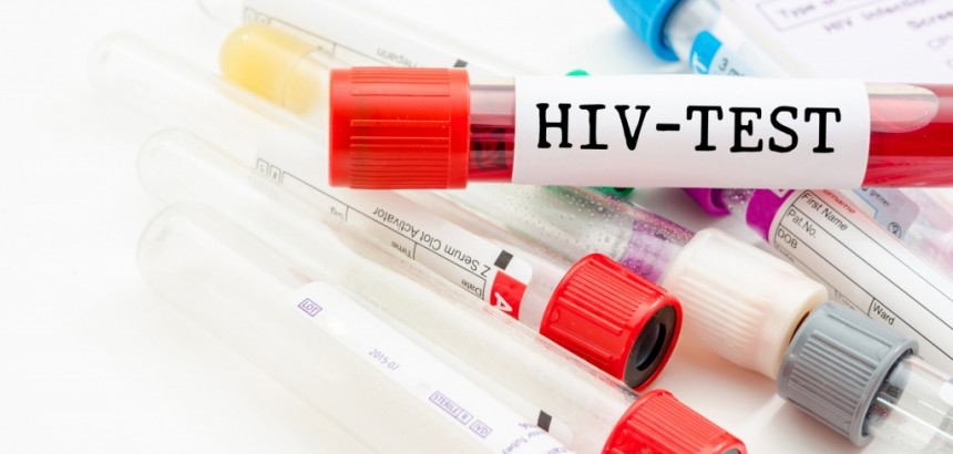 Экспресс-тестирование на ВИЧ и гепатит В 24.04-28.04.2023