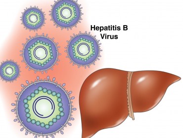 Гепатит В