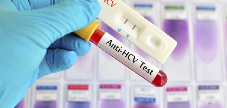 Экспресс тестирование на ВИЧ и гепатит С с 25.09.23-29.09.23