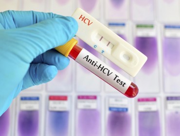 Экспресс тестирование на ВИЧ и гепатит С с 25.09.23-29.09.23